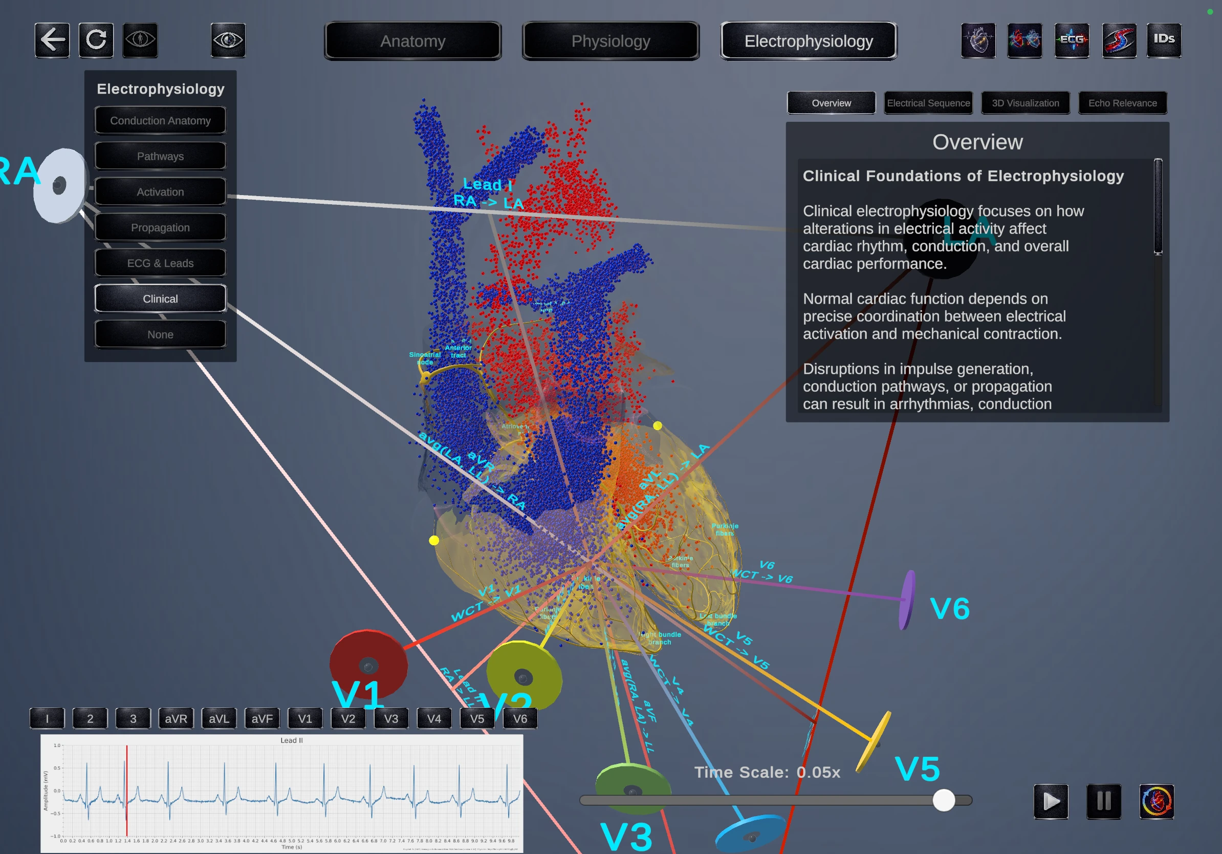 Electrophysiology view 2