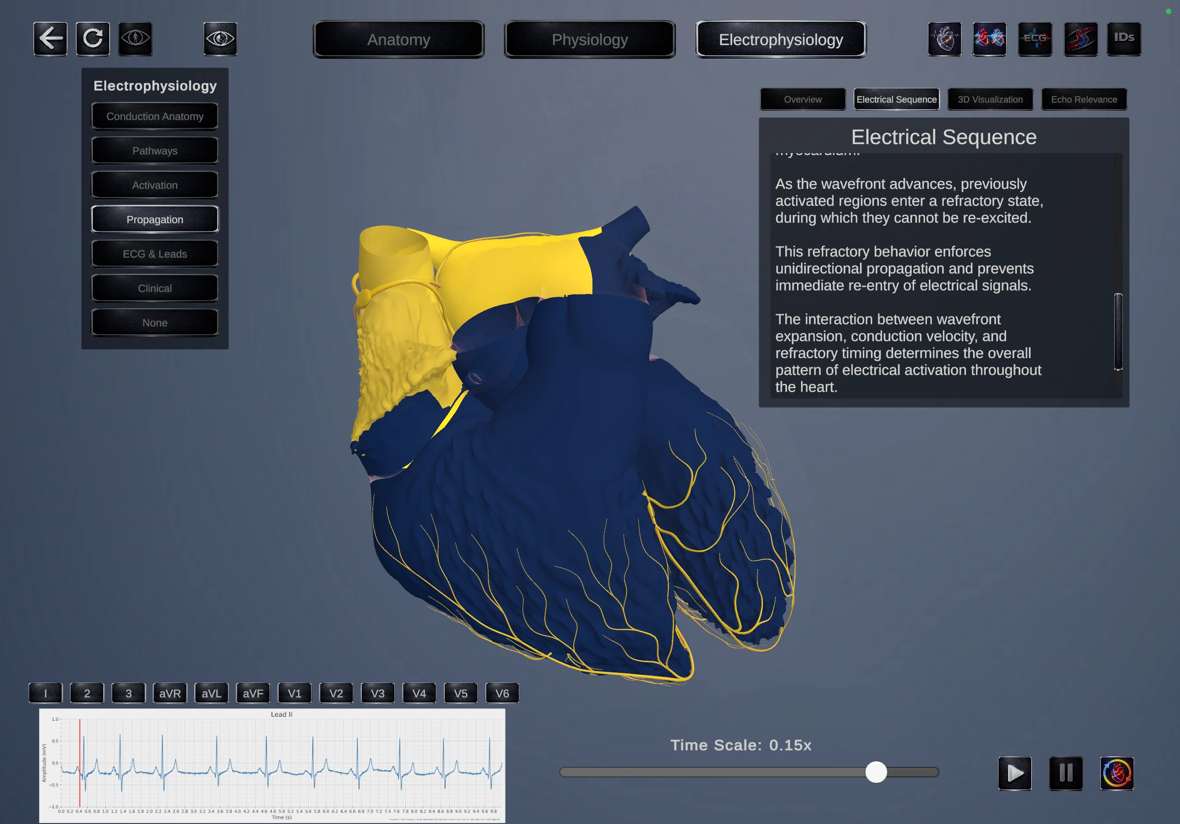 Electrophysiology view 1